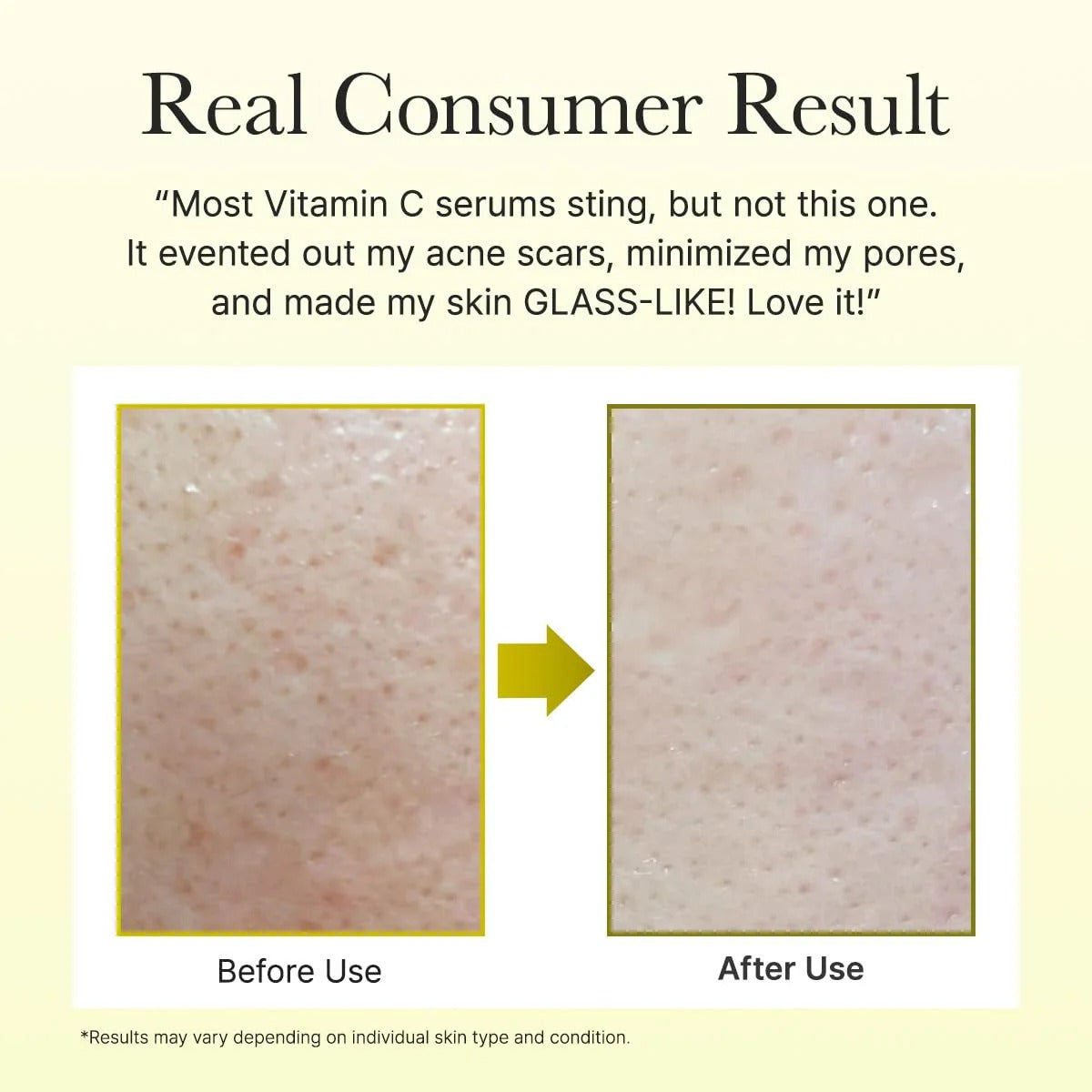 Arencia Vitamin C Booster Shot 30ml – Brightening Serum for Dark Spots, Uneven Skin Tone & Radiant Glow |